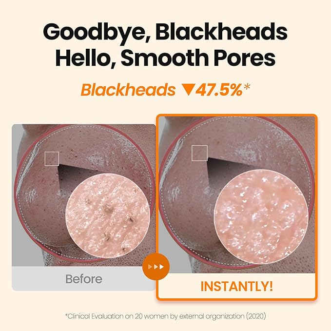 [K-Beauty] Calendula Biome Oil to Foam - All-in-One Korean Face Wash OilBased Foaming Facial Cleanser - Hydrating, Moisturizing & Soothing Makeup Deep Cleansing Oil for All Skin Types (3.88 fl oz)